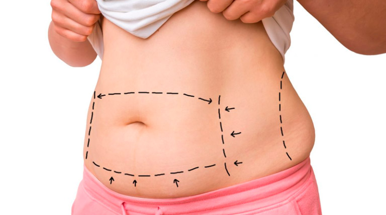 Read more about the article Cirurgia bariátrica: Melhora nas doenças associadas à obesidade